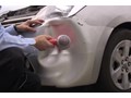 Những cách nắn ba đờ sốc có thể tự làm tại nhà